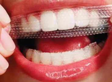 You Must Know When to Make Use of Teeth Whitening Strips