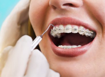 3 Tips for Keeping Your Teeth Clean During Orthodontic Treatment
