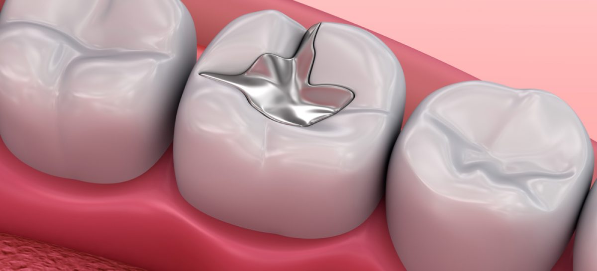 Everything You Need To Know About Restorative Dentistry