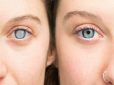 Why does combining multiple nutrients enhance diabetic eye protection?