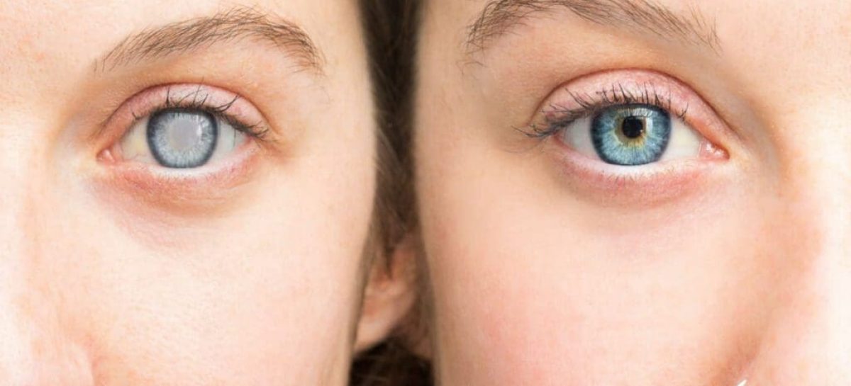 Why does combining multiple nutrients enhance diabetic eye protection?
