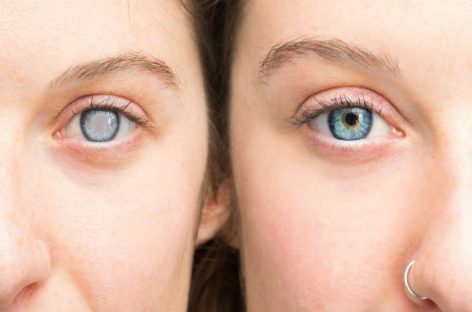 Why does combining multiple nutrients enhance diabetic eye protection?